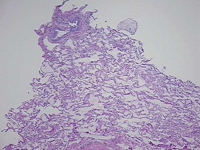 4x Image