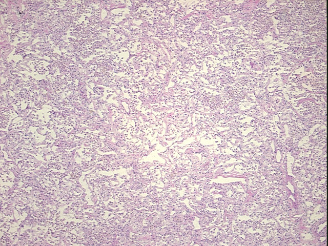 4x Image
