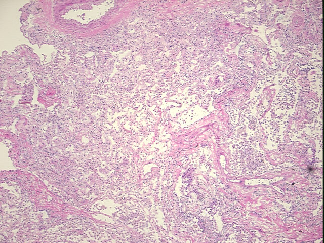 4x Image