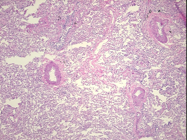 4x Image