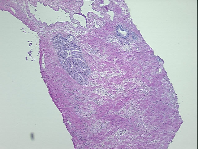 4x Image