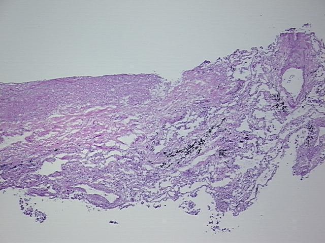 4x Image