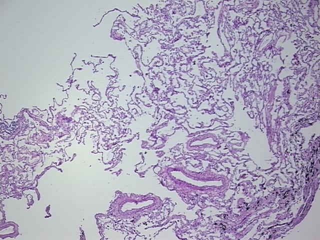 4x Image