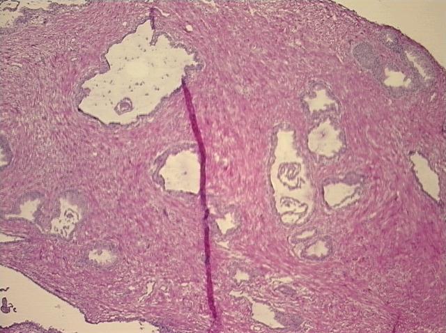 4x Image