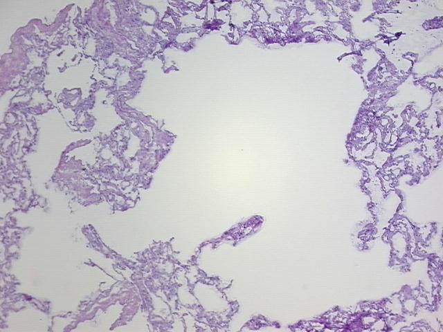 4x Image