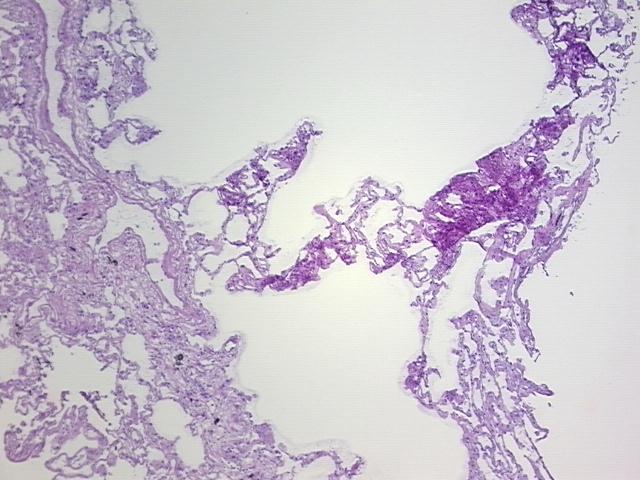 4x Image