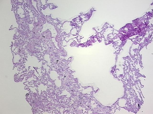 4x Image