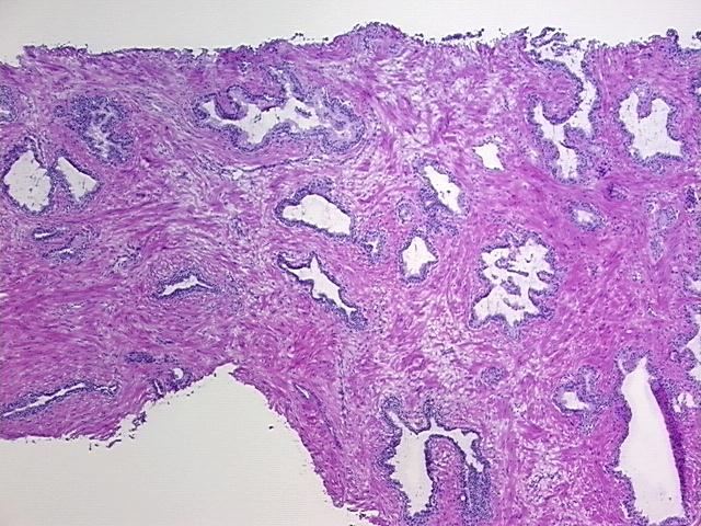 4x Image