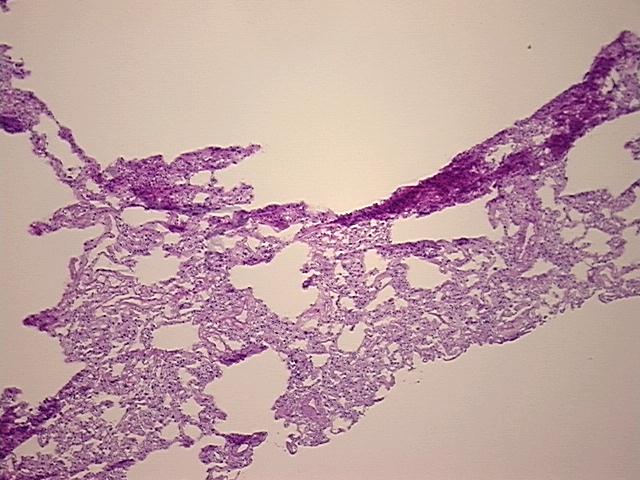 4x Image