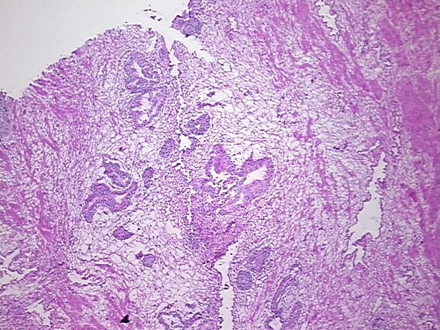 4x Image