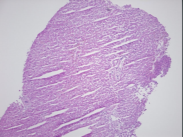 4x Image