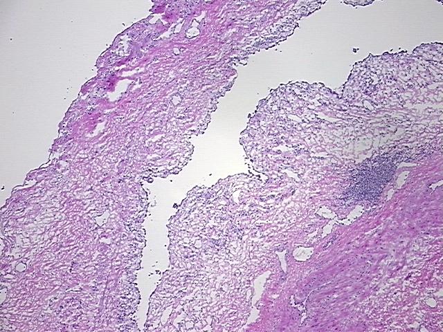 4x Image