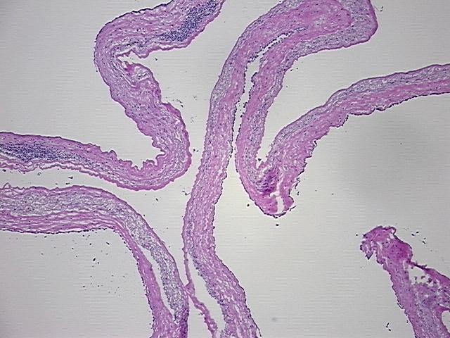 4x Image