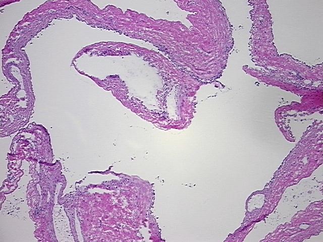4x Image