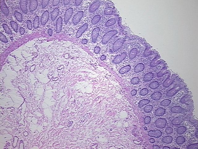 4x Image