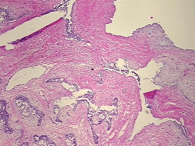 4x Image