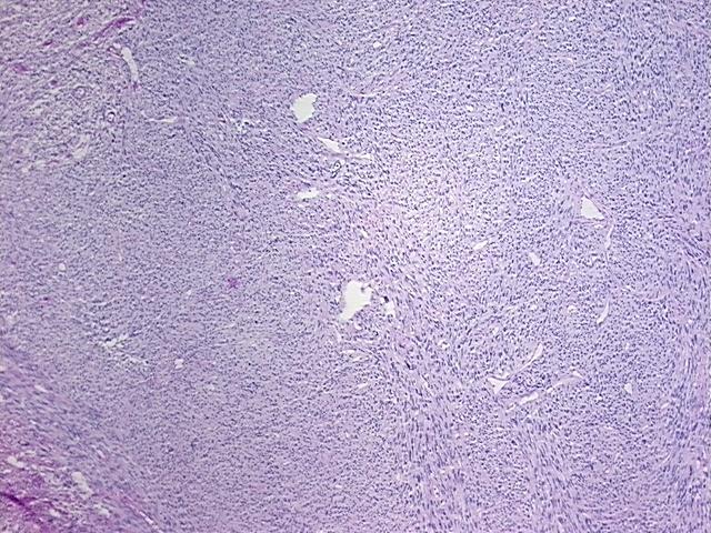 4x Image