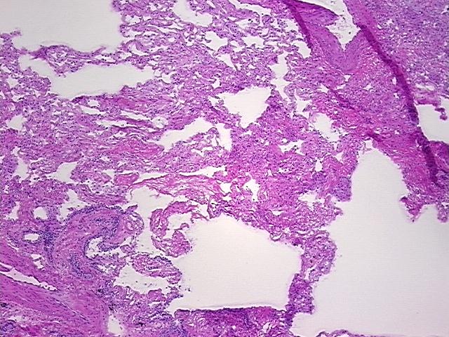 4x Image