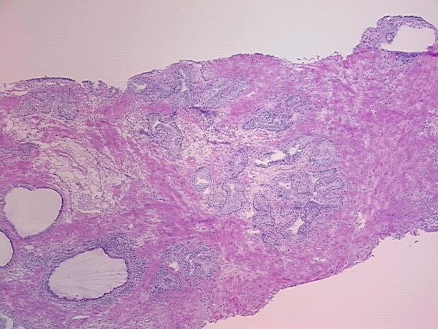 4x Image