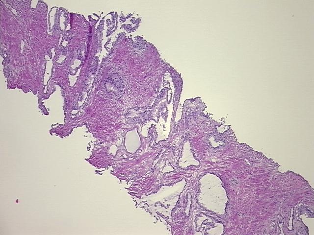 4x Image