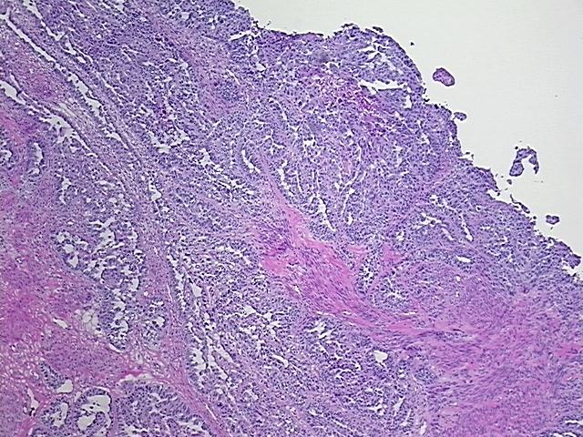 4x Image
