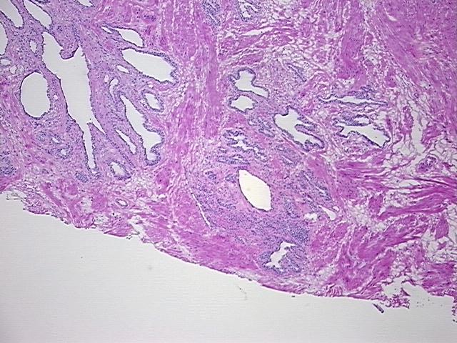 4x Image
