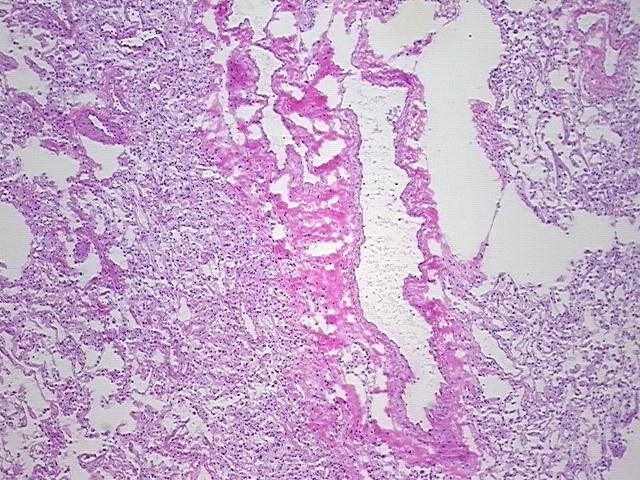 4x Image