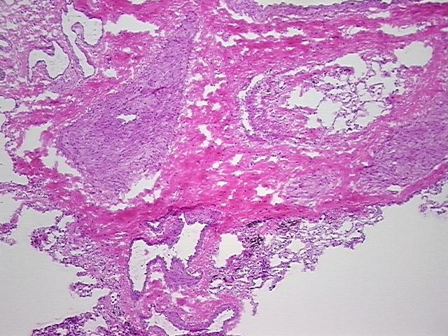 4x Image