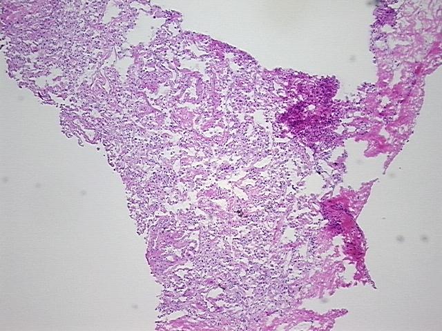 4x Image