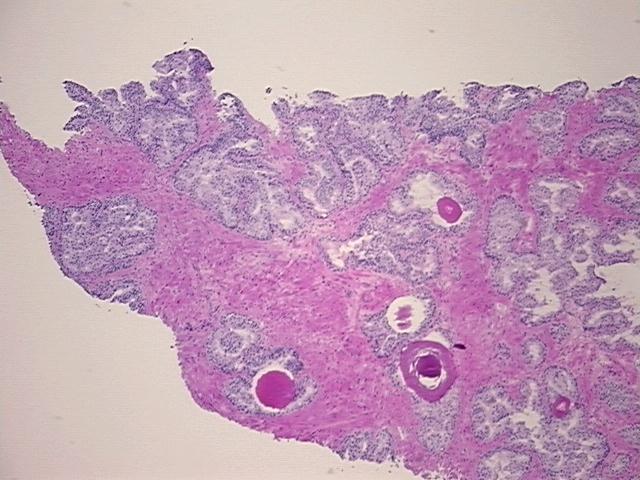 4x Image