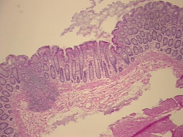 4x Image