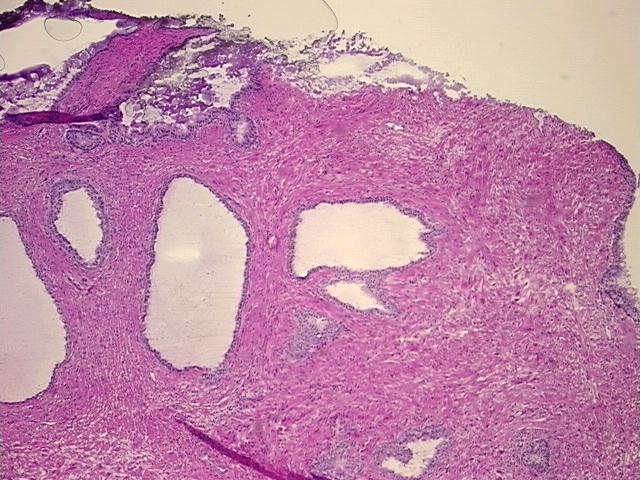 4x Image