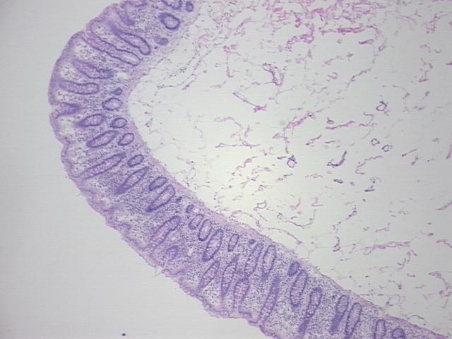 4x Image