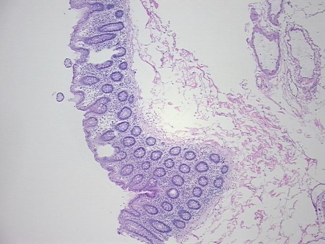4x Image