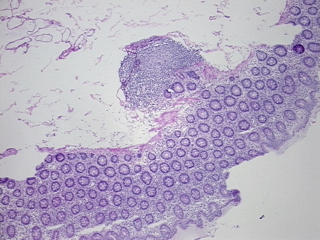 4x Image