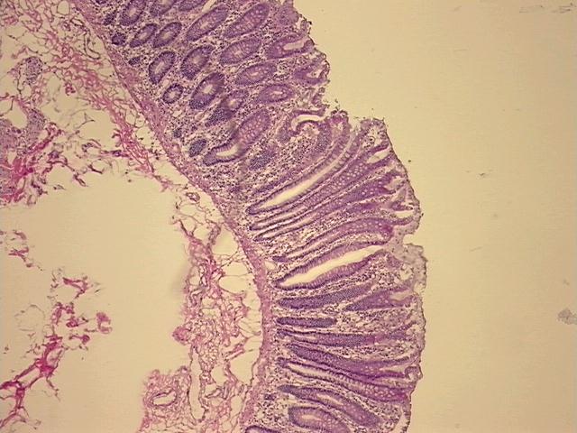 4x Image