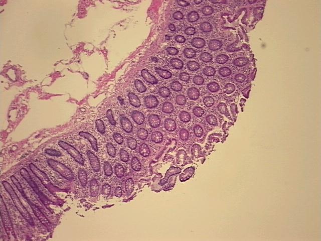 4x Image