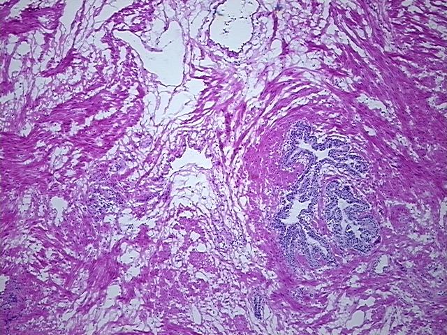 4x Image
