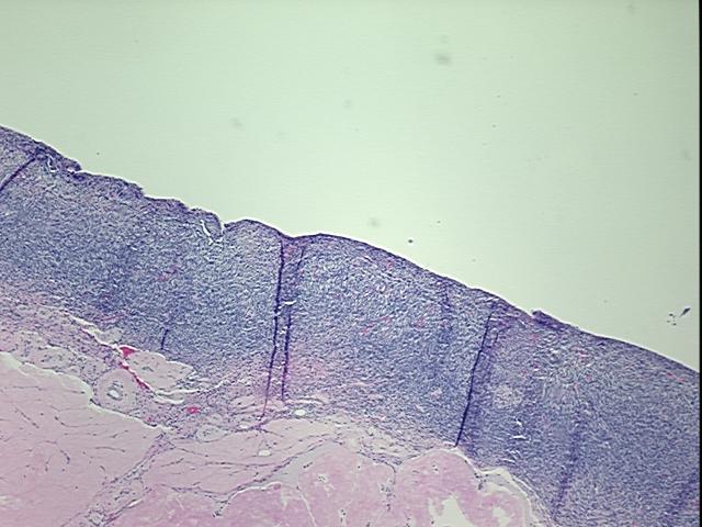 4x Image