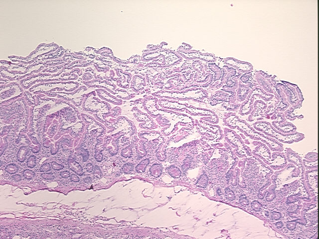 4x Image