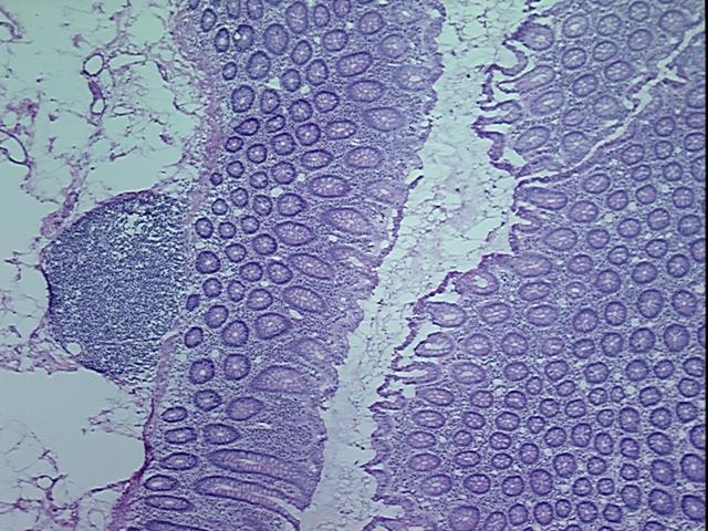 4x Image