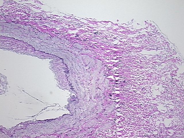 4x Image