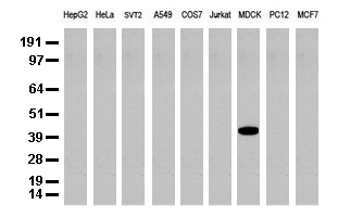 Western blot analysis of extracts (35 ug) from 9 different cell lines by using anti-CK19 monoclonal antibody (Clone UMAB3) at 1:500.