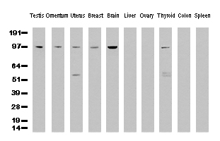 Western Blot analysis of 10 different human tissue lysates (10 ug) by using anti-XPF monoclonal antibody (clone UMAB20, 1:500)