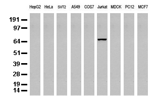 Western blot analysis of extracts (35 ug) from 9 different cell lines by using anti-DEF6 monoclonal antibody (Clone UMAB51).