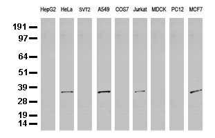 Western blot analysis of extracts (35 ug) from 9 different cell lines by using anti-SDCBP monoclonal antibody (Clone UMAB69).
