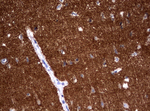 Immunohistochemical staining of paraffin-embedded Human ad ult brain tissue using anti-SYT4 mouse monoclonal antibody. (UM500093; heat-induced epitope retrieval by 10mM citric buffer, pH6.0, 120°C for 3min)