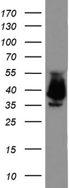 Western blot analysis of LOVO cell lysate (35 ug) by using anti-EPCAM monoclonal antibody.