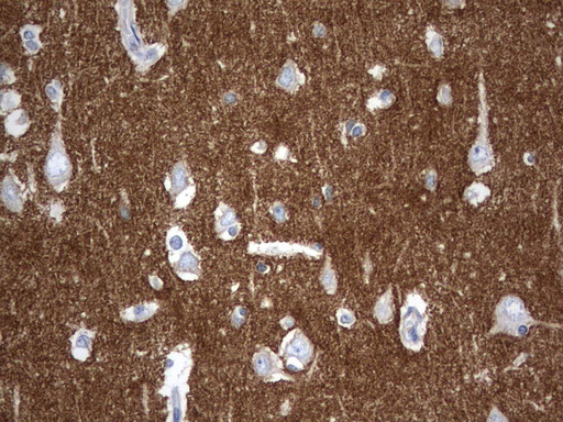 Immunohistochemical staining of paraffin-embedded Human ad ult brain tissue using anti-SYT4 mouse monoclonal antibody. (UM500103, heat-induced epitope retrieval by 1mM EDTA in 10mM Tris, pH8.0, 120°C for 3min)