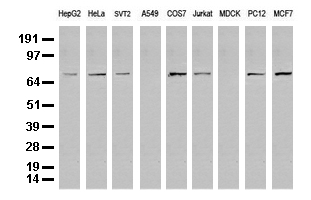 Western blot analysis of extracts (35 ug) from 9 different cell lines by using anti-FOXP1 monoclonal antibody (Clone UMAB89).